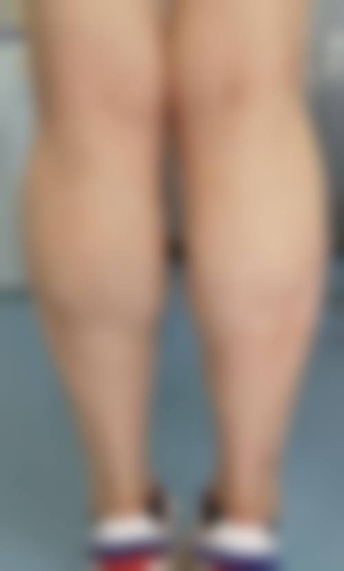 优惠活动:让美丽更可及