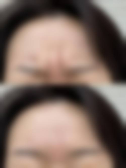 总结与预约
