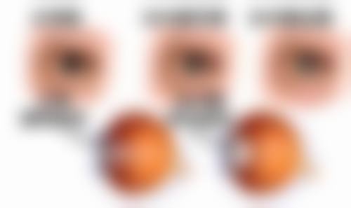关于广州德视佳眼科门诊部,你可能关心的问题(快问快答)
