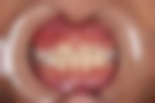 怎么预约杭州明冠口腔诊所?就诊指南请收好