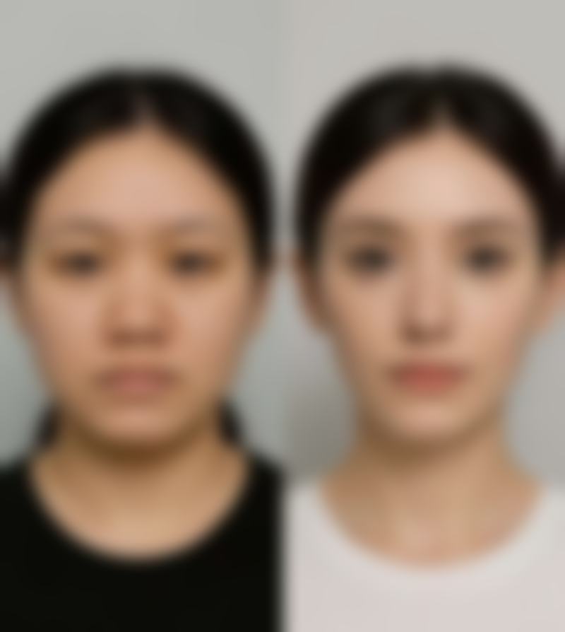 珠海大懒虫医疗美容诊所的特色项目,哪些适合你